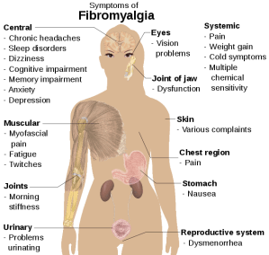 632px-Symptoms_of_fibromyalgia.svg